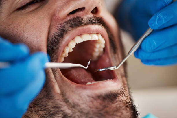 Best Emergency Treatment for Oral Infections in Poplar Plains, CT