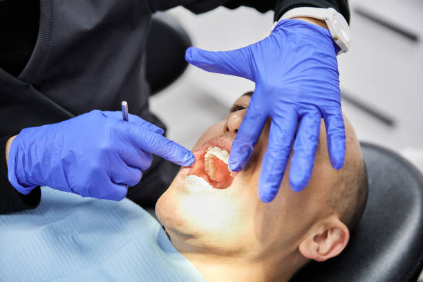 Best Emergency Dental Care for Sports Injuries in Poplar Plains, CT